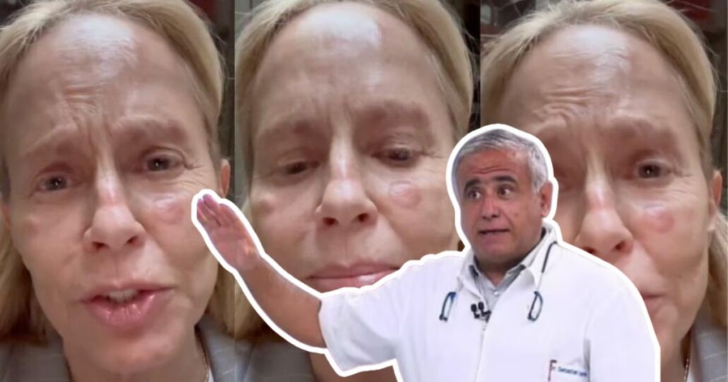 El Dr. Ugarte alerta sobre las preocupantes «manchas» en el rostro de Cecilia Bolocco: Podrían indicar «sospechas».