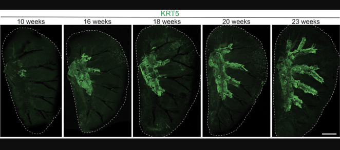 Podrían ser la causa del cáncer de pulmón.