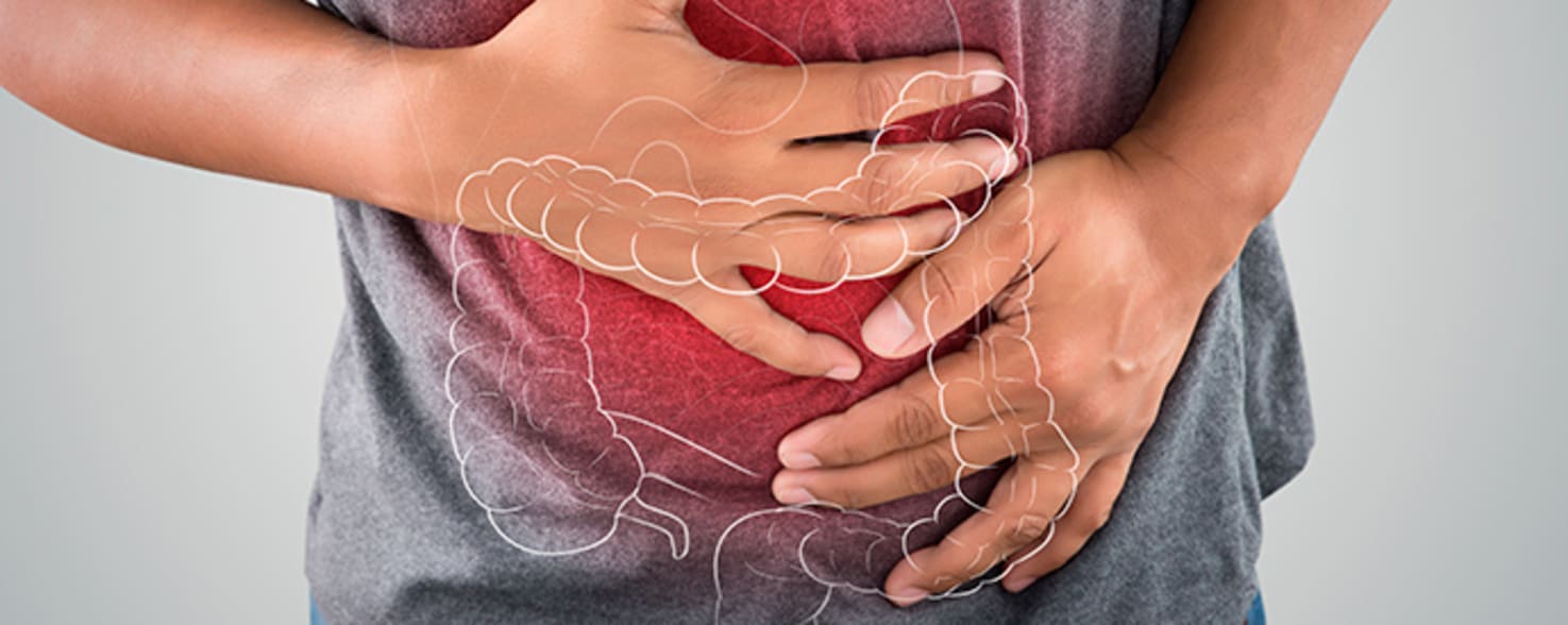 Tratamiento de enfermedades inflamatorias intestinales en Chile