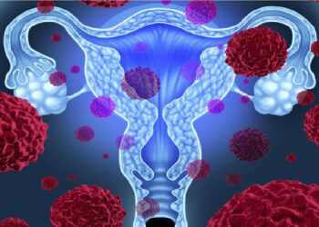 El virus sigiloso que puede provocar cáncer de cuello uterino.