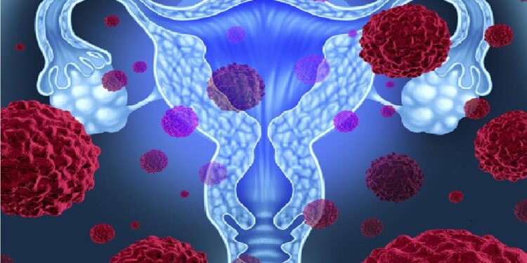 El virus sigiloso que puede provocar cáncer de cuello uterino.