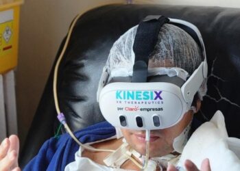 Se utilizan lentes 3D de realidad inmersiva para la rehabilitación de pacientes en la UCI del Hospital Dr. Eduardo Pereira de Valparaíso.