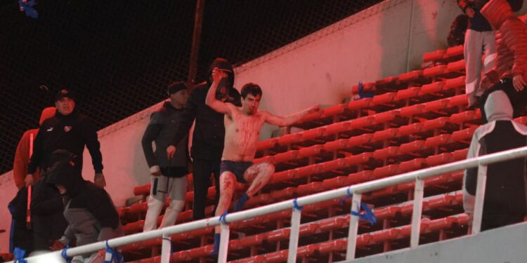 19 aficionados de la «U» heridos en disturbios en Argentina: uno se encuentra en estado crítico.