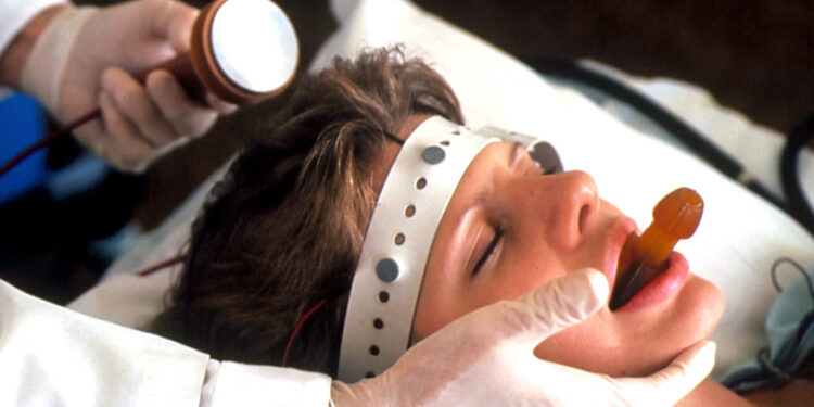 Tribunal de Santiago aprueba terapia electroconvulsiva para un menor a pesar de la oposición de su madre.