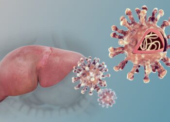 La enfermedad que pone en jaque la salud del hígado.