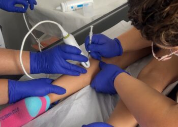 Hospital Roberto del Río ayuda a los cabros con parálisis cerebral a moverse mejor gracias al bótox.