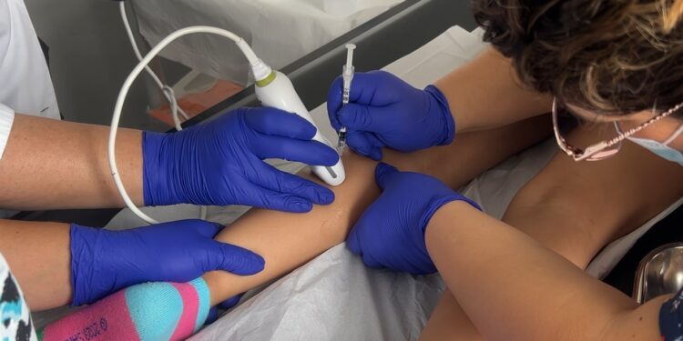 Hospital Roberto del Río ayuda a los cabros con parálisis cerebral a moverse mejor gracias al bótox.