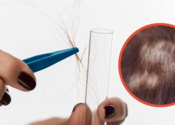 Municipalidad de Lampa se hace test de drogas para dar más transparencias a la gente.