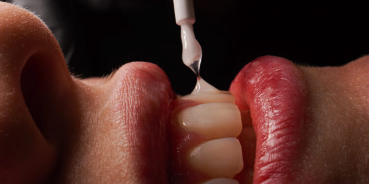 Salud dental y cáncer: tips para evitar complicaciones.