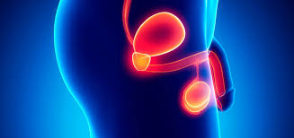 Nueva terapia oral facilita el tratamiento del cáncer de próstata avanzado en Chile.