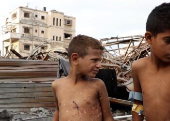 Crisis en Gaza: 6 mil personas han sufrido amputaciones y el sistema de salud está al borde del colapso.