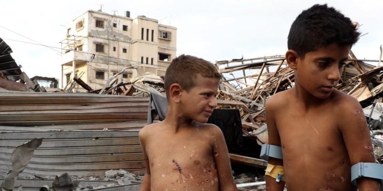 Crisis en Gaza: 6 mil personas han sufrido amputaciones y el sistema de salud está al borde del colapso.