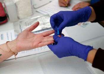 U. de Chile hará una jornada gratuita para hacerse test rápido de VIH.