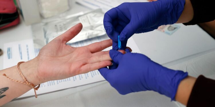 U. de Chile hará una jornada gratuita para hacerse test rápido de VIH.