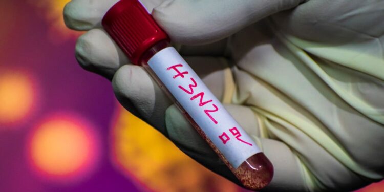 Minsal confirma el primer caso en Chile de la nueva variante de influenza A(H3N2).