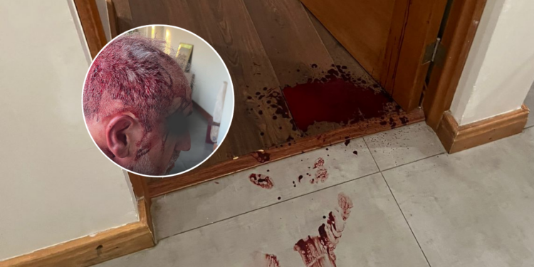 Robo violento en Talca afecta a un destacado académico y a su familia en su hogar.