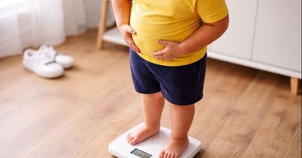 El sobrepeso infantil en Chile llega a su punto más crítico entre los 10 y 14 años.